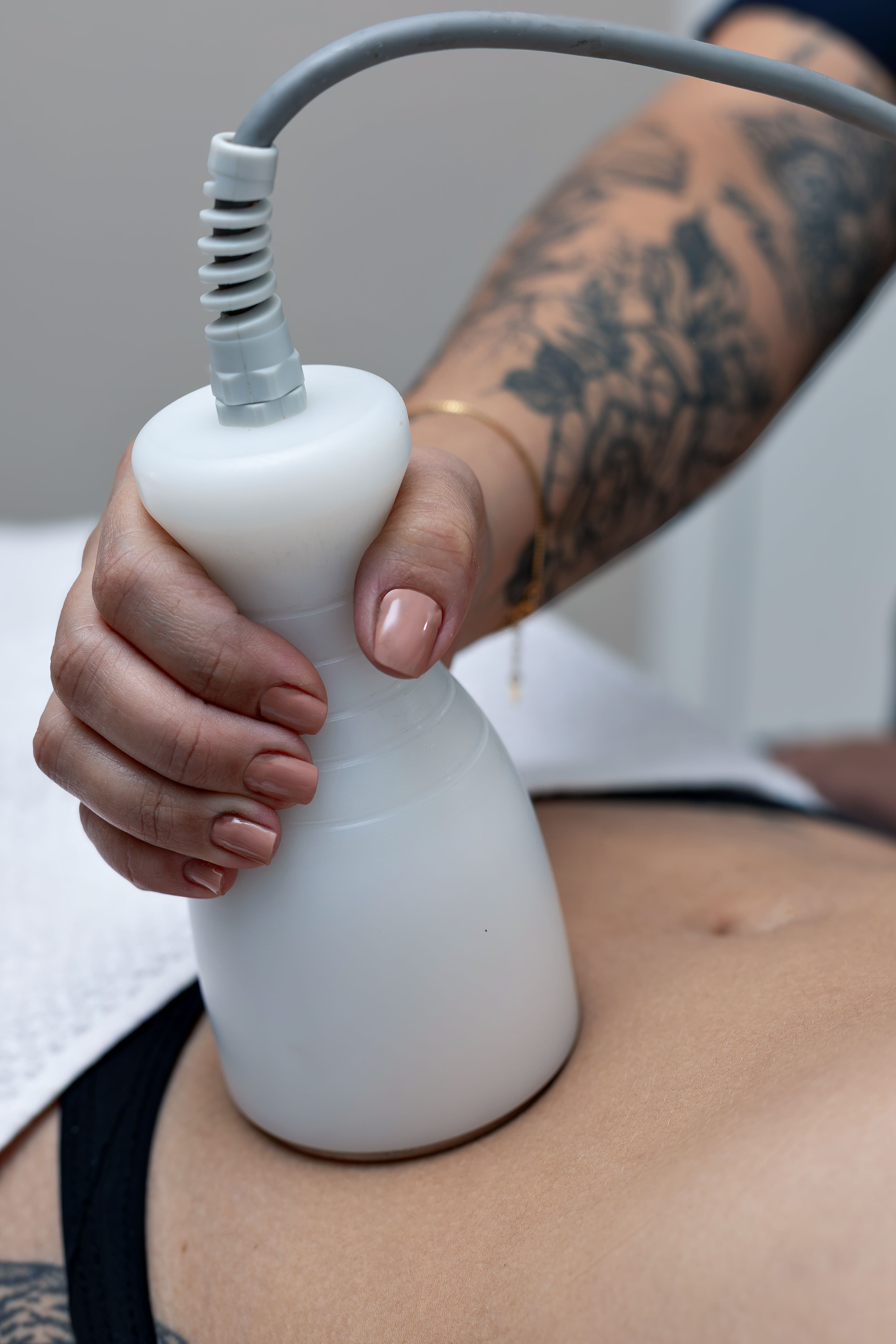 Body contouring treatment